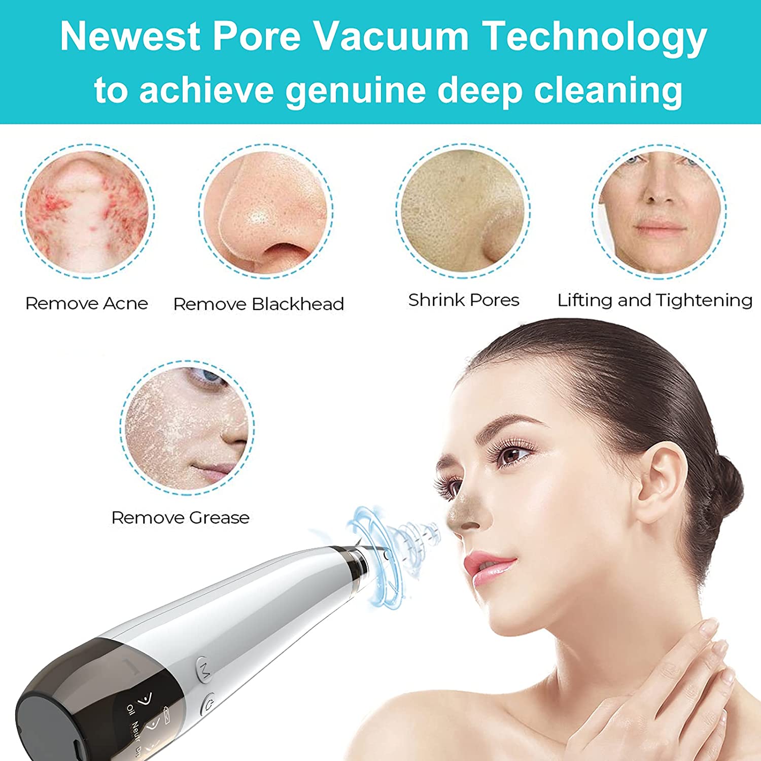 Blackhead Remover l Blackhead Removal Vacuum Suction & & Acne Remover Facial Tool - Image 2